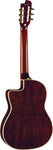 MIA IV Nylon Eq.